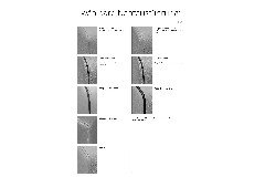 CL 500 von Erpo Polstermöbel - Ledergarnitur rechts mocca