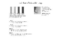 Porto von Erpo Polstermöbel - Ledergarnitur links dunkelbraun
