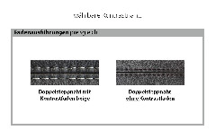 PN-EM18063 von Polinova - Ledergarnitur Variante rechts olive