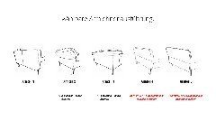 Modern Classic NL von Gruber - Eckgarnitur Variante rechts basalt