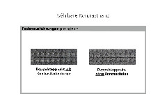 PP-LA24122 von Polipol - Ecksofa Ausführung links forest